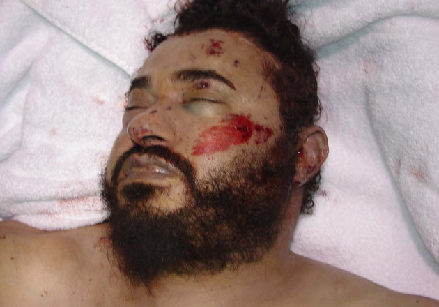 A dead Zarqawi - photo released by the DoD.