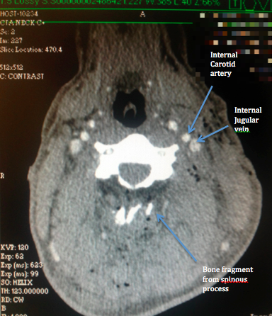 Screen-Shot-2015-11-29-at-4.23.30-pm