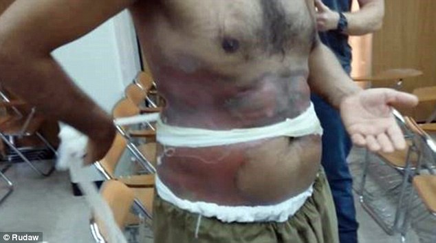 ISIS made and used chemical weapons in Iraq and Syria