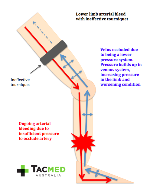 Screen Shot 2015-12-17 at 2.20.06 pm