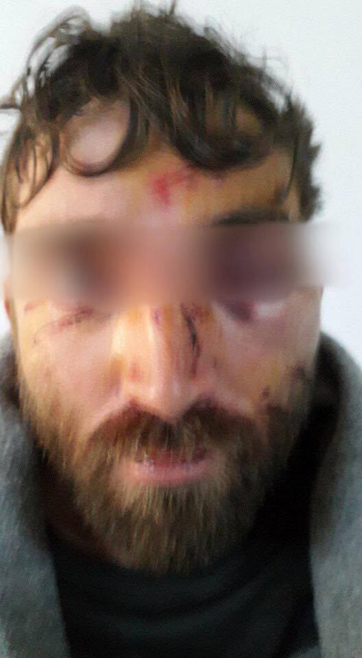 Voluteer who got beat up