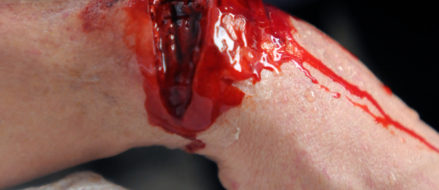 Combat Casualty Care Training : Using Moulage to Add Realism