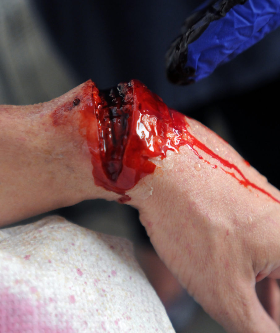 Combat Casualty Care Training : Using Moulage to Add Realism