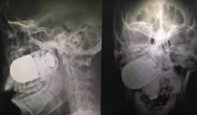 Screen_Shot_2016-06-14_at_8.22.11_AM_xfhqgu