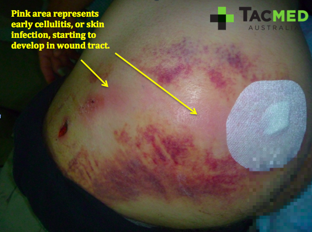 Screen Shot 2016-07-30 at 11.45.54 AM