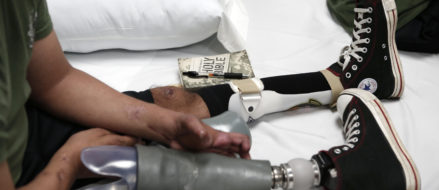 Healing America’s heroes: Prosthetic alternatives allow mobility, independence