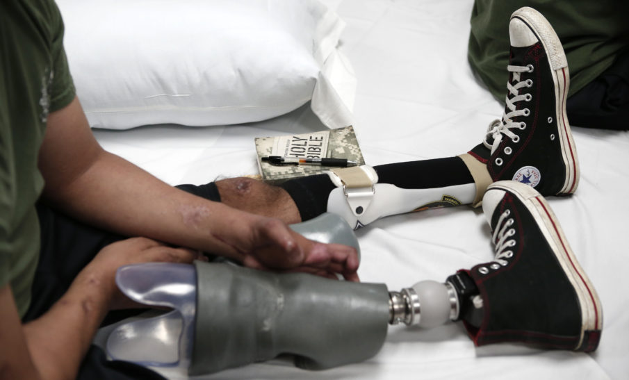 Healing America’s heroes: Prosthetic alternatives allow mobility, independence