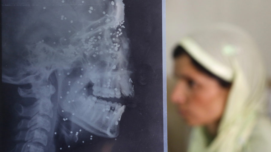 The doctors treating Kashmiris blinded by pellets