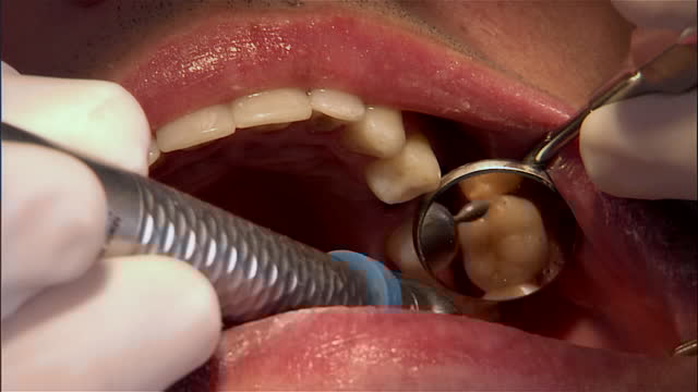 Hundreds of VA dental patients possibly exposed to HIV, hepatitis