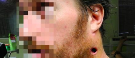 A bullet to the neck couldn’t stop him