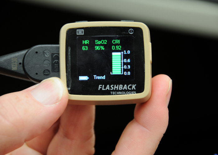 Army device receives FDA approval; Could revolutionize trauma treatment in the field