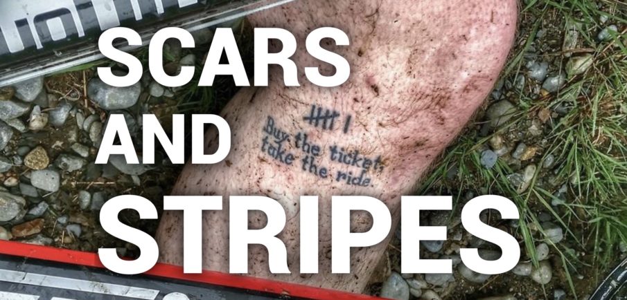 Old Man Fitness: I never want to stop earning these scars